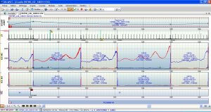 Logiciel ULTRAPOT (2)